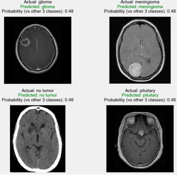 Brain Tumour Detection project screenshot
